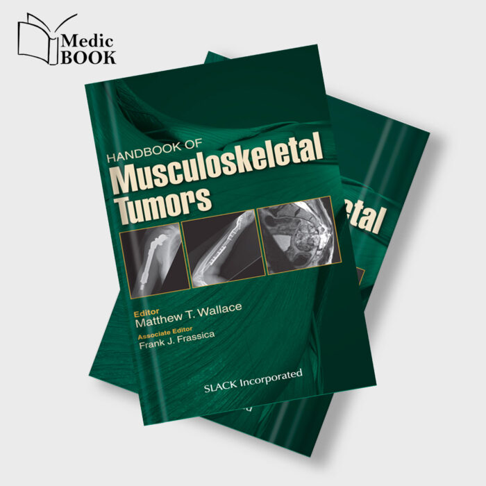 Handbook Of Musculoskeletal Tumors (EPUB)
