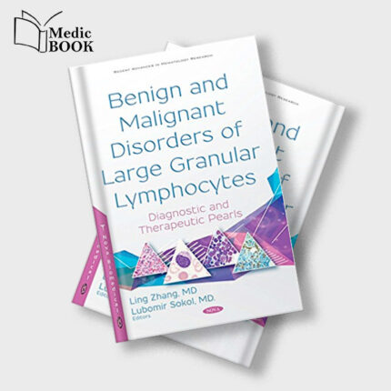 Benign and Malignant Disorders of Large Granular Lymphocytes : Diagnostic and Therapeutic Pearls (Original PDF from Publisher)