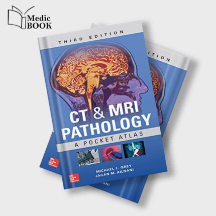 CT and MRI Pathology : A Pocket Atlas , Third Edition (ORIGINAL PDF from Publisher)