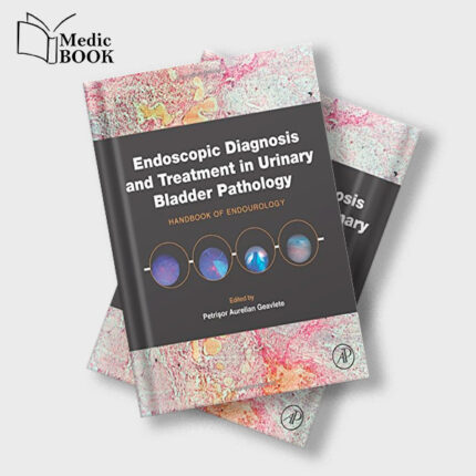 Endoscopic Diagnosis and Treatment in Urinary Bladder Pathology : Handbook of Endourology