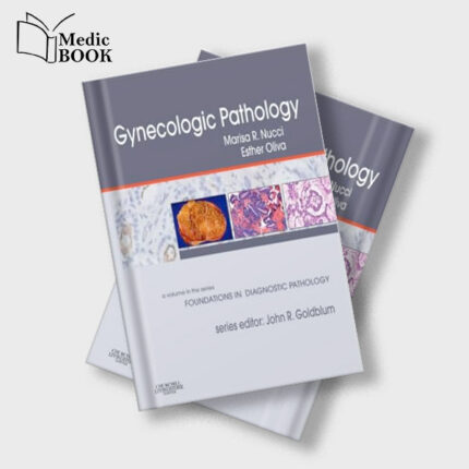 Gynecologic Pathology : A Volume in Foundations in Diagnostic Pathology Series