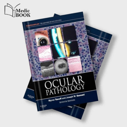 Ocular Pathology : Expert Consult Online and Print , 7e (ORIGINAL PDF from Publisher)