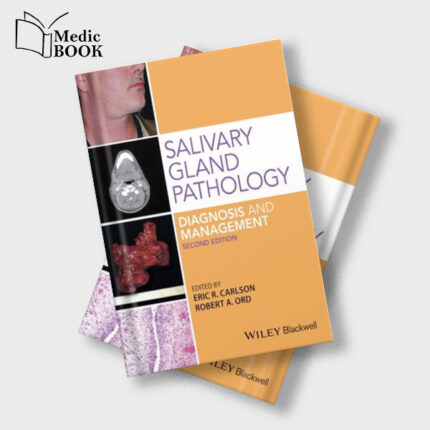Salivary Gland Pathology : Diagnosis and Management , 2nd Edition