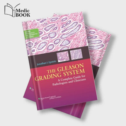 The Gleason Grading System : A Complete Guide for Pathologist and Clinicians