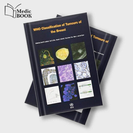WHO Classification of Tumours of the Breast (IARC WHO Classification of Tumours) (Retail PDF)