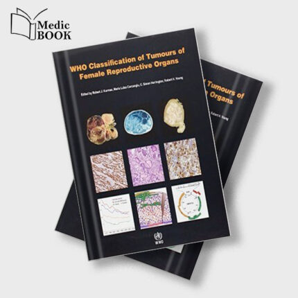WHO Classification of Tumours of the Female Reproductive Organs (IARC WHO Classification of Tumours) (Retail PDF)