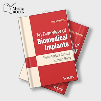 An Overview of Biomedical Implants : Biomaterials for the Human Body (Original PDF from Publisher)