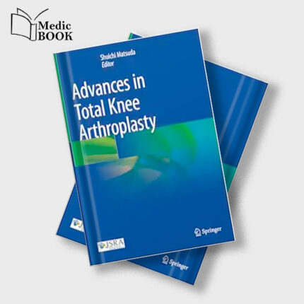 Advances in Total Knee Arthroplasty (Original PDF from Publisher)