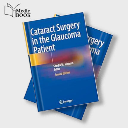 Cataract Surgery in the Glaucoma Patient , 2nd Edition (Original PDF from Publisher)