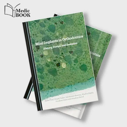 Mini Implants in Orthodontics : History , Design and Evolution (Original PDF from Publisher)
