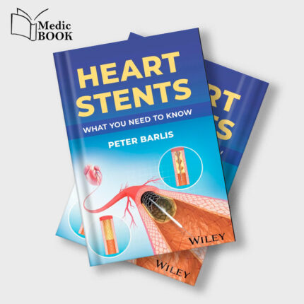Heart Stents (EPUB)