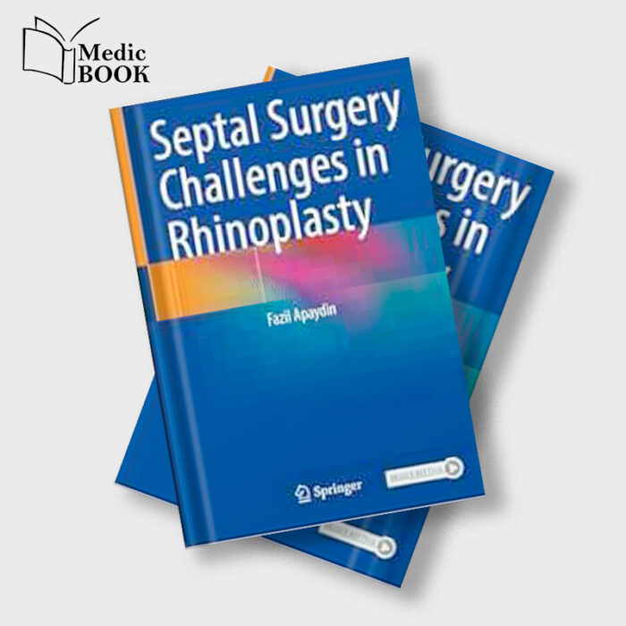 Septal Surgery Challenges in Rhinoplasty Original PDF from Publisher