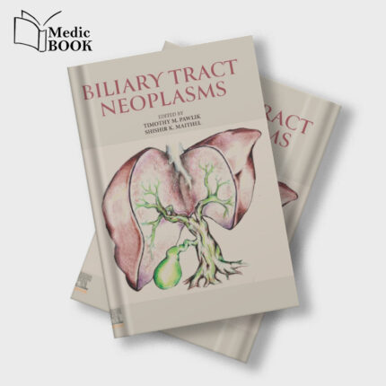 Biliary Tract Neoplasms (True PDF from Publisher)