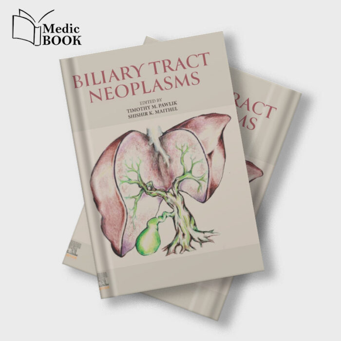 Biliary Tract Neoplasms (True PDF from Publisher)