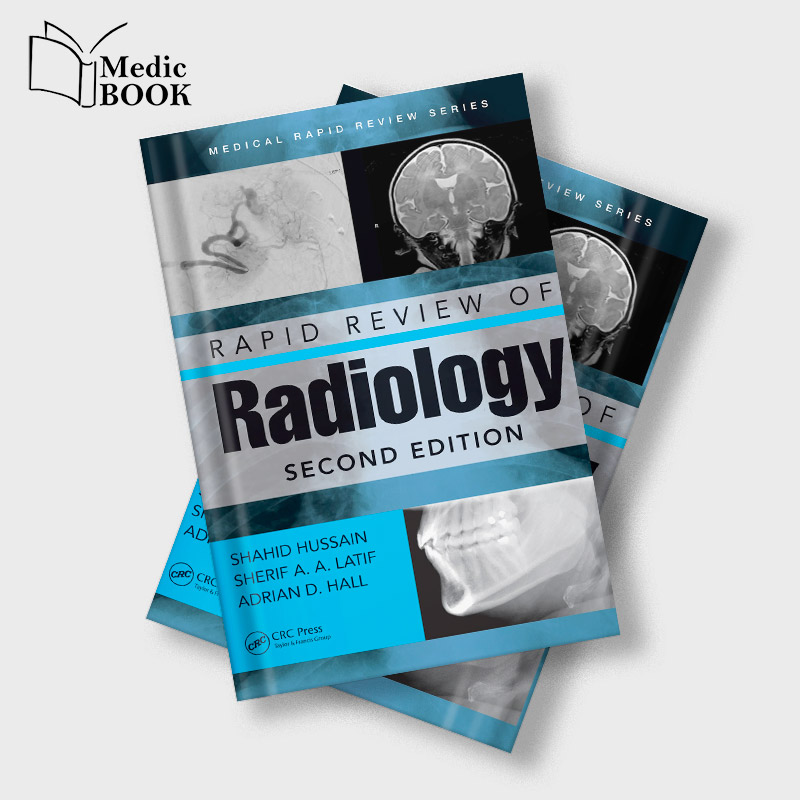 Rapid-Review-of-Radiology,-2nd-Edition-(Original-PDF-from-Publisher) Rapid Review of Radiology, 2nd Edition (Original PDF from Publisher)